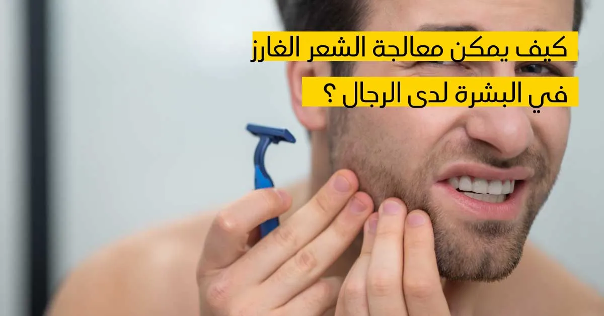 كيف يمكن معالجة الشعر الغارز في البشرة لدى الرجال ؟